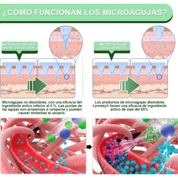 Lenreey® Parche de Microagujas Nano GIP+GLP-1