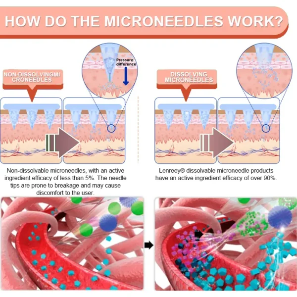 Lenreey® SMGT-GLP-1 Nano Microneedle Patch