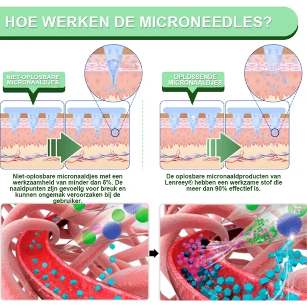 Lenreey® NIDDK-Tirzepatide Matrixyl 3000 Nano Microneedle Patch